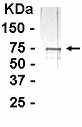 Anti-TLR2 antibody (ab14275) at 1/2000 dilution + Fusion protein derived in E.Coli