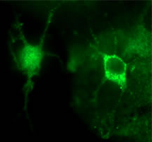 Ab13556 positively staining formaldehyde fixed rat primary microglia cells (1/50), used in conjunction with goat anti rabbit Alex Flour ® 488 (1/250).  This image is courtesy of an Abreview submitted on 3 October 2005. We do not have any further information relating to this image.