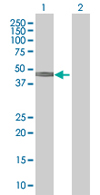 All lanes : Anti-SLC38A3 antibody (ab67574) at 1/500 dilutionLane 1 : SLC38A3 transfected 293T cell lysateLane 2 : Non-transfected 293T cell lysateLysates/proteins at 25 µg per lane.SecondaryGoat Anti-Mouse IgG (H&L)-HRP Conjugate at 1/2500 dilution