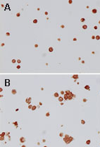 ICC analysis of TLR4 in formalin-fixed Ramos (a) and 293 (b) cells using ab47093 at 1:10 dilution. Data courtesy of Dr. Regina Gandour-Edwards. 
