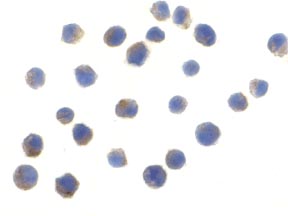 ab37072 at 10 µg/ml staining TLR6 in Jurkat cells by ICC/IF