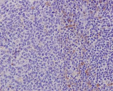 Immunohistochemistry (Formalin/PFA-fixed paraffin-embedded sections) analysis of human tonsil tissue labelling TLR7 with unpurified ab124928 at 1/100. Heat mediated antigen retrieval was performed using Tris/EDTA buffer pH 9. A prediluted HRP-polymer conjugated anti-rabbit IgG was used as the secondary antibody. Counterstained with hematoxylin.
