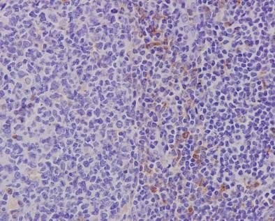 Immunohistochemistry (Formalin/PFA-fixed paraffin-embedded sections) analysis of human tonsil tissue labelling TLR7 with purified ab124928 at 1/100. Heat mediated antigen retrieval was performed using Tris/EDTA buffer pH 9. A prediluted HRP-polymer conjugated anti-rabbit IgG was used as the secondary antibody. Counterstained with hematoxylin.