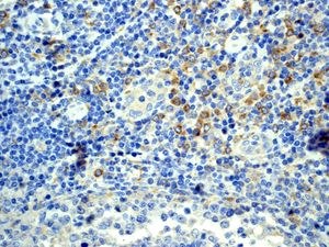 Immunohistochemistry (Formalin/PFA-fixed paraffin-embedded sections) analysis of human tonsil tissue labelling TLR7 with unpurified ab124928 at 1/100.