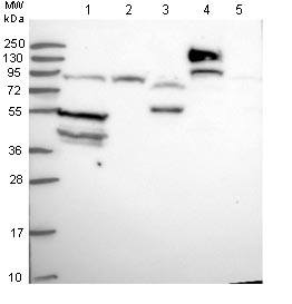 All lanes : Anti-SLC38A9 antibody (ab130398) at 1/250 dilutionLane 1 : RT4 cell lysateLane 2 : U-251 MG cell lysateLane 3 : Human Plasma lysateLane 4 : Human Liver lysateLane 5 : Human Tonsil lysate