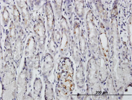 ab88497, at 3 µg/ml, staining Silencer of Death Domain in formalin fixed, paraffin embedded human stomach tissue section by Immunohistochemistry.