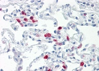 Immunohistochemical analysis of formalin-fixed, paraffin-embedded Human lung tissue labeling TLR9 with ab151221 at 20 µg/ml.