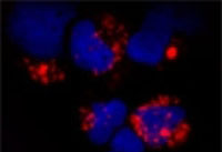 ab85860 at 1/100 dilution staining TLR9 in Human plasmacytoid dendritic cells by Immunofluorescence. Cells were fixed with 2% formaldehyde and incubated with an anti-Rabbit secondary antibody conjugated with Alexa 586. The nuclei were counterstained with DAPI.