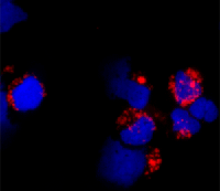 ab85860 at 1/100 dilution staining TLR9 in Human plasmacytoid dendritic cells by Immunofluorescence. Cells were fixed with 2% formaldehyde and incubated with an anti-Rabbit secondary antibody conjugated with Alexa 586. The nuclei were counterstained with DAPI.