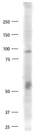 Anti-TLR9 antibody - Cytoplasmic domain (ab85860) at 1/500 dilution + Monomac 6 cell lysate (boiled and reduced)SecondaryHRP-conjugated goat anti-rabbit IgG at 1/10000 dilutiondeveloped using the ECL technique