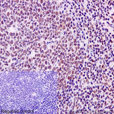 Immunohistochemistry (Formalin/PFA-fixed paraffin-embedded sections) analysis of human tonsil tissue labelling TLS/FUS with unpurified ab133571 at 1/50. Heat mediated antigen retrieval was performed using Tris/EDTA buffer pH 9. A prediluted HRP-polymer conjugated anti-rabbit IgG was used as the secondary antibody. Negative control using PBS instead of primary antibody. Counterstained with Hematoxylin.