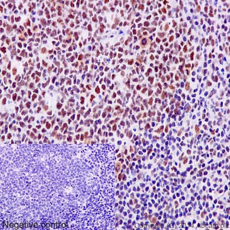 Immunohistochemistry (Formalin/PFA-fixed paraffin-embedded sections) analysis of human tonsil tissue labelling TLS/FUS with purified ab133571 at 1/100. Heat mediated antigen retrieval was performed using Tris/EDTA buffer pH 9. A prediluted HRP-polymer conjugated anti-rabbit IgG was used as the secondary antibody. Negative control using PBS instead of primary antibody. Counterstained with Hematoxylin.