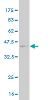 Western blot against tagged recombinant protein immunogen using ab58244 TM4SF3 antibody at 1ug/ml.