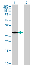 All lanes : Anti-TMA16 antibody (ab69429) at 1/500 dilutionLane 1 : FLJ11184 transfected 293T cell lysateLane 2 : Non-transfected 293T cell lysateLysates/proteins at 25 µg per lane.SecondaryGoat Anti-Mouse IgG (H&L)-HRP Conjugate at 1/2500 dilution