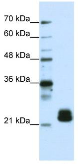 Lane 1 :  MarkerLane 2 :  Anti-TMED4 antibody (ab50634) at 1.25 µg/mlLane 1 : As aboveLane 2 : HepG2 cell lysates at 10 µgSecondaryLane 2 : HRP conjugated anti-Rabbit IgG at 1/50000 dilution