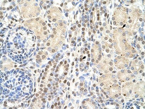 IHC-P: Human Kidney Cells with positive lable: epithelial cells of renal tubule Conc. of ab50634: 4.0 - 8.0 µg/ml