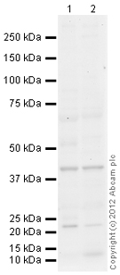 All lanes : Anti-TMEM173 antibody (ab124612) at 1 µg/mlLane 1 : Thymus (Human) Tissue Lysate - adult normal tissue (ab30146)Lane 2 : Spleen (Human) Tissue Lysate - adult normal tissue (ab29699)Lysates/proteins at 10 µg per lane.SecondaryGoat Anti-Rabbit IgG H&L (HRP) (ab97051) at 1/10000 dilutiondeveloped using the ECL techniquePerformed under reducing conditions.
