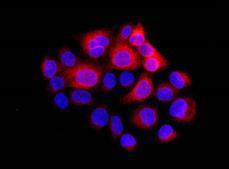 Immunofluorescence analysis of HACAT cells (fixative 4% paraformaldehyde) labeling TMEM173 with ab181125 at a 1/100 dilution, and counterstained with DAPI. Goat anti rabbit IgG (Dylight 555) secondary used at a 1/200 diution.
