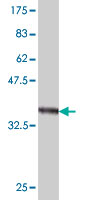 Western blot against tagged recombinant protein immunogen using ab57566 TMPRSS3 antibody at 1ug/ml.