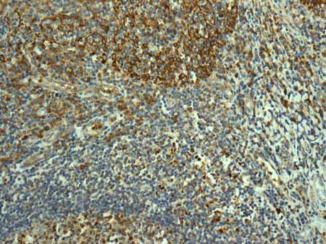 ab167160 showing +ve staining in Human normal tonsil.