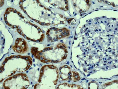 ab167160 showing +ve staining in Human normal kidney.