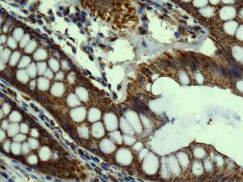 ab167160 showing +ve staining in Human normal colon.