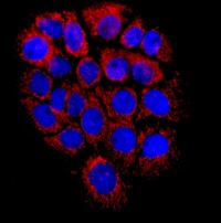Immunocytochemical analysis of A431 cells labeling TMPRSS3 with ab167160 at a 1/250 dilution.