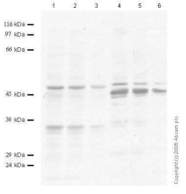 All lanes : Anti-TMPRSS4 antibody (ab56117) at 1/1000 dilutionLane 1 : Tissue lysate from mouse pancreasLane 2 : Tissue lysate from mouse pancreasLane 3 : Tissue lysate from mouse pancreasLane 4 : Whole cell lysate prepared from Madin Darby canine kidney (MDCK) cellsLane 5 : Whole cell lysate prepared from Madin Darby canine kidney (MDCK) cellsLane 6 : Whole cell lysate prepared from Madin Darby canine kidney (MDCK) cells