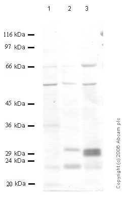 All lanes : Anti-TMPRSS5 antibody (ab56121) at 1/1000 dilutionLane 1 : Tissue lysate prepared from rat prostateLane 2 : Tissue lysate prepared from rat stomachLane 3 : Tissue lysate prepared from rat uterus