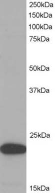 Anti-TMS1 antibody (ab2236) at 1 µg/ml + Cell lysate prepared from human Hella cells at 35 µgdeveloped using the ECL technique