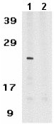 All lanes : Anti-TMS1 antibody (ab8394) at 1 µg/mlLane 1 : HL60 whole cell lysate with absence of blocking peptideLane 2 : HL60 whole cell lysate with presence of blocking peptideObserved band size : 25 kDa (why is the actual band size different from the predicted?)