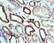 Immunohistochemical analysis of paraffin-embedded Human kidney tissue labelling Silencer of Death Domain with ab134051 at 1/100 dilution.