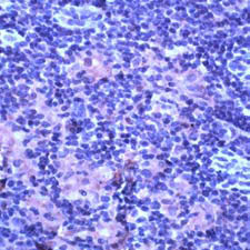 ab15563 staining TNF Receptor II at 1/50 dilution in thymus by Immunohistochemistry (FFPE-sections). 