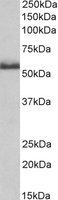 Anti-TNF Receptor II antibody (ab119998) at 0.2 µg/ml + Rat spinal cord lysate (in RIPA buffer) at 35 µgdeveloped using the ECL technique
