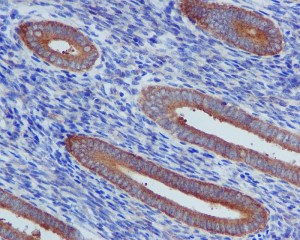 ab109322, at a 1/100 dilution, staining TNF Receptor II in paraffin embedded uterus tissue by Immunohistochemistry.