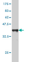 Western blot against tagged recombinant protein immunogen using ab57570 SLC44A2 antibody at 1ug/ml.