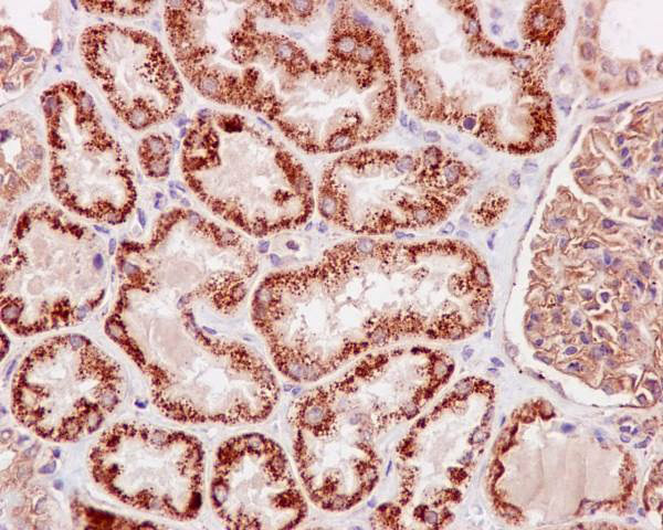 Immunohistochemistry (Formalin/PFA-fixed paraffin-embedded sections) analysis of human kidney tissue labelling TNFAIP3 with purified ab92324 at 1/100. Heat mediated antigen retrieval was performed using Tris/EDTA buffer pH 9. A prediluted HRP-polymer conjugated anti-rabbit IgG was used as the secondary antibody. Counterstained with Hematoxylin.