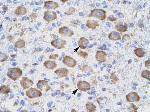 Immunohistochemistry (Formalin/PFA-fixed paraffin-embedded sections) analysis of human brain tissue labelling TNFRSF18 with ab10030 at 4µg/ml. Staining seen in neural cells.
