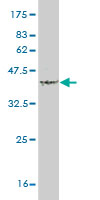 Western blot against tagged recombinant protein immunogen using ab56352 TNFSF18 antibody at 1ug/ml.