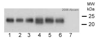 All lanes : Anti-TNNI1 antibody [12F10] (ab8293) at 1 µg/mlLane 1 : 40ug human muscle lysate (whole tissue)Lane 2 : 40ug human muscle lysate (whole tissue)Lane 3 : 40ug human muscle lysate (whole tissue)Lane 4 : 40ug human muscle lysate (whole tissue)Lane 5 : 40ug human muscle lysate (whole tissue)Lane 6 : 40ug human muscle lysate (whole tissue)Lane 7 : 40ug rat adipose lysate (whole tissue)SecondaryHRP donkey anti-mouse HRPdeveloped using the ECL techniquePerformed under non-reducing conditions.Observed band size : 22 kDa (why is the actual band size different from the predicted?)Exposure time :  5 secondsThis image is courtesy of an anonymous AbreviewSee Abreview