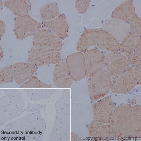 Immunohistochemical analysis of paraffin-embedded Human skeletal muscle tissue labeling TNNI1 with ab202422 at 1/400 dilution, followed by Goat Anti-Rabbit IgG H&L (HRP) (ab97051) secondary antibody at 1/500 dilution. Cytoplasmic staining on Human skeletal muscle tissue is observed. Counter stained with Hematoxylin.Secondary antibody only control: Used PBS instead of primary antibody, secondary antibody is Goat Anti-Rabbit IgG H&L (HRP) (ab97051) at 1/500 dilution.