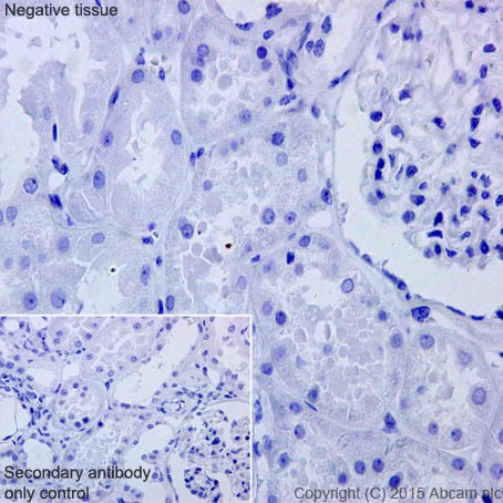 Immunohistochemical analysis of paraffin-embedded Human kidney tissue labeling TNNI1 with ab202422 at 1/400 dilution, followed by Goat Anti-Rabbit IgG H&L (HRP) (ab97051) secondary antibody at 1/500 dilution. No staining on human kidney tissue is observed. Counter stained with Hematoxylin.Secondary antibody only control: Used PBS instead of primary antibody, secondary antibody is Goat Anti-Rabbit IgG H&L (HRP) (ab97051) at 1/500 dilution.