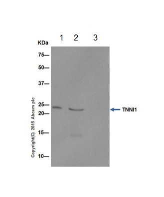 TNNI1 was immunoprecipitated from 1mg of Human fetal heart whole cell lysate with ab202422 at 1/40 dilution. Western blot was performed from the immunoprecipitate using ab202422 at 1/5000 dilution. Anti-Rabbit IgG (HRP), specific to the non-reduced form of IgG, was used as secondary antibody at 1/1500 dilution.Lane 1: Human fetal heart whole cell lysate 10 µg (Input). Lane 2: ab202422 IP in Human fetal heart whole cell lysate. Lane 3: Rabbit monoclonal IgG (ab172730) instead of ab202422 in Human fetal heart whole cell lysate.Blocking and dilution buffer and concentration: 5% NFDM/TBST.Exposure time: 1 second.