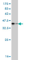 Western blot against tagged recombinant protein immunogen using ab58267 TNNT3 antibody at 1ug/ml.