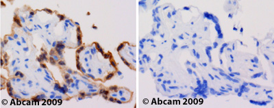 ab37155 staining Tollip in human placenta.Left panel: with primary antibody at 2 ug/ml. Right panel: isotype control.Sections were stained using an automated system (DAKO Autostainer Plus), at room temperature: sections were rehydrated and antigen retrieved with the Dako 3 in 1 AR buffers EDTA pH 9.0. Slides were peroxidase blocked in 3% H2O2 in methanol for 10 mins. They were then blocked with Dako Protein block for 10 minutes (containing casein 0.25% in PBS) then incubated with primary antibody for 20 min and detected with Dako envision flex amplification kit for 30 minutes. Colorimetric detection was completed with Diaminobenzidine for 5 minutes. Slides were counterstained with Haematoxylin and coverslipped under DePeX. Please note that for manual staining we recommend to optimize the primary antibody concentration and incubation time (overnight incubation), and amplification may be required.