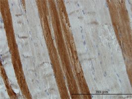 TOM1 antibody (ab56949) used in immunohistochemistry at 3ug/ml on formalin fixed and paraffin embedded human skeletal muscle.