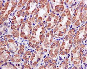 Immunohistochemical analysis of paraffin-embedded Human stomach tissue labeling TOM1 with ab170928 at 1/250 dilution.