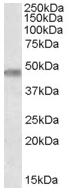 Anti-TOM1L1 antibody (ab77601) at 0.3 µg/ml + Human Brain (Cerebellum) lysate (in RIPA buffer) at 35 µg
