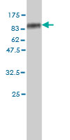 Western blot against tagged recombinant protein immunogen using ab56512 SLC4A4 antibody at 1ug/ml.