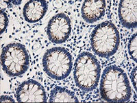 ab124027, at 1/150 dilution, staining TOMM34 in paraffin-embedded Human colon tissue by Immunohistochemistry.